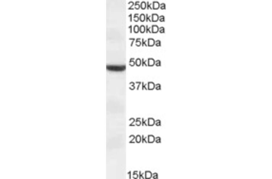 Western Blot - Anti-TMPRSS4 Antibody (A83314) - Antibodies.com