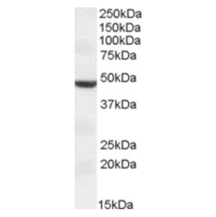 Western Blot - Anti-TMPRSS4 Antibody (A83314) - Antibodies.com