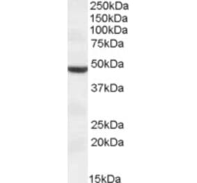 Western Blot - Anti-TMPRSS4 Antibody (A83314) - Antibodies.com