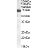 Western Blot - Anti-ZDHHC13 Antibody (A83315) - Antibodies.com