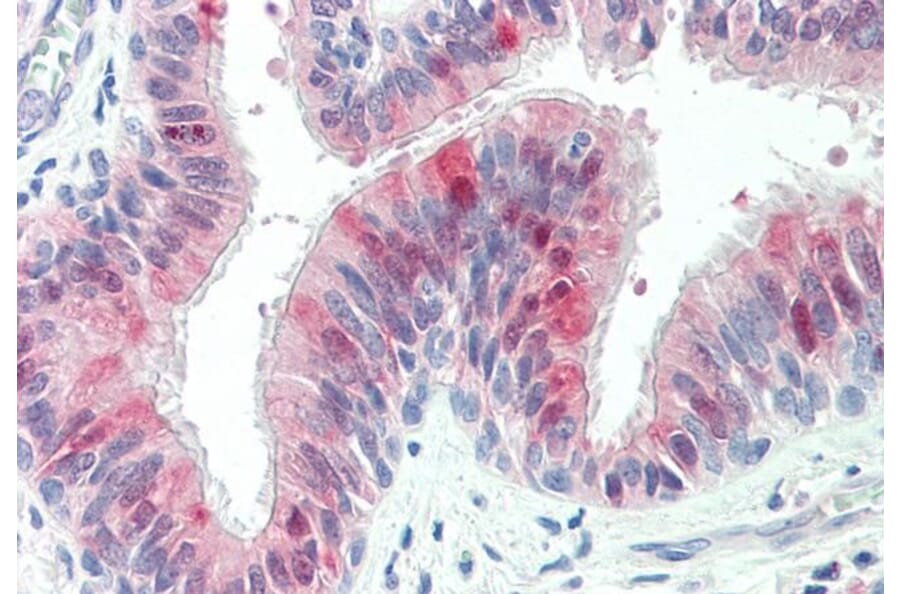 Immunohistochemistry - Anti-ZDHHC13 Antibody (A83315) - Antibodies.com