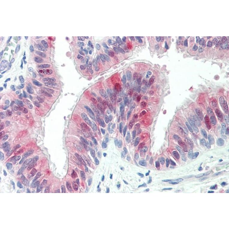 Immunohistochemistry - Anti-ZDHHC13 Antibody (A83315) - Antibodies.com