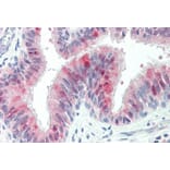 Immunohistochemistry - Anti-ZDHHC13 Antibody (A83315) - Antibodies.com