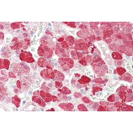 Immunohistochemistry - Anti-EHM2 Antibody (A83316) - Antibodies.com