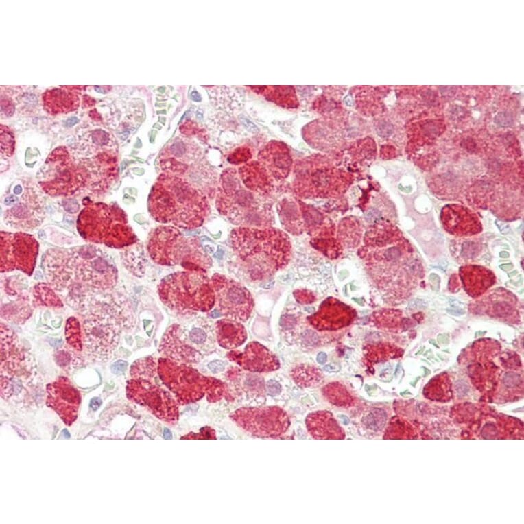 Immunohistochemistry - Anti-EHM2 Antibody (A83316) - Antibodies.com