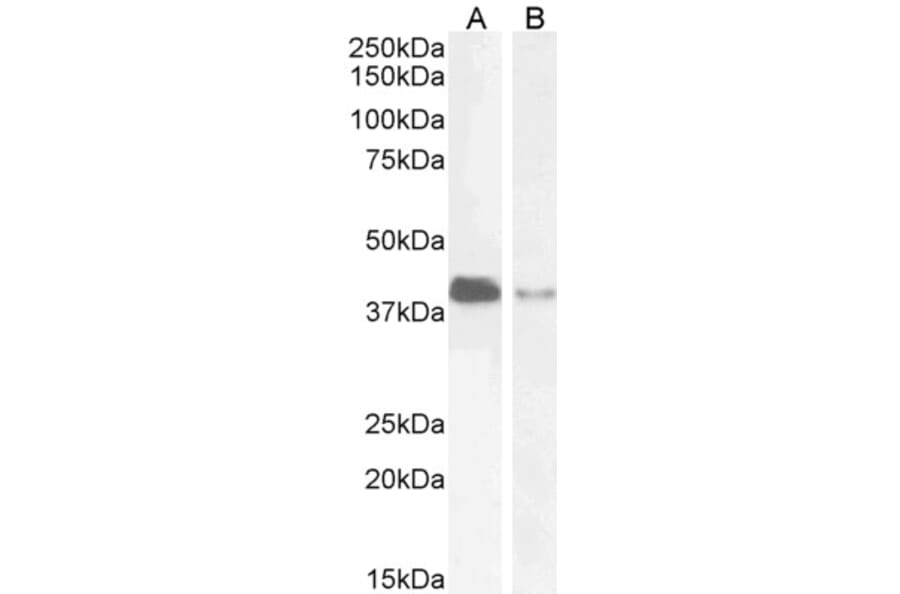 Western Blot - Anti-PAR6 alpha Antibody (A83318) - Antibodies.com