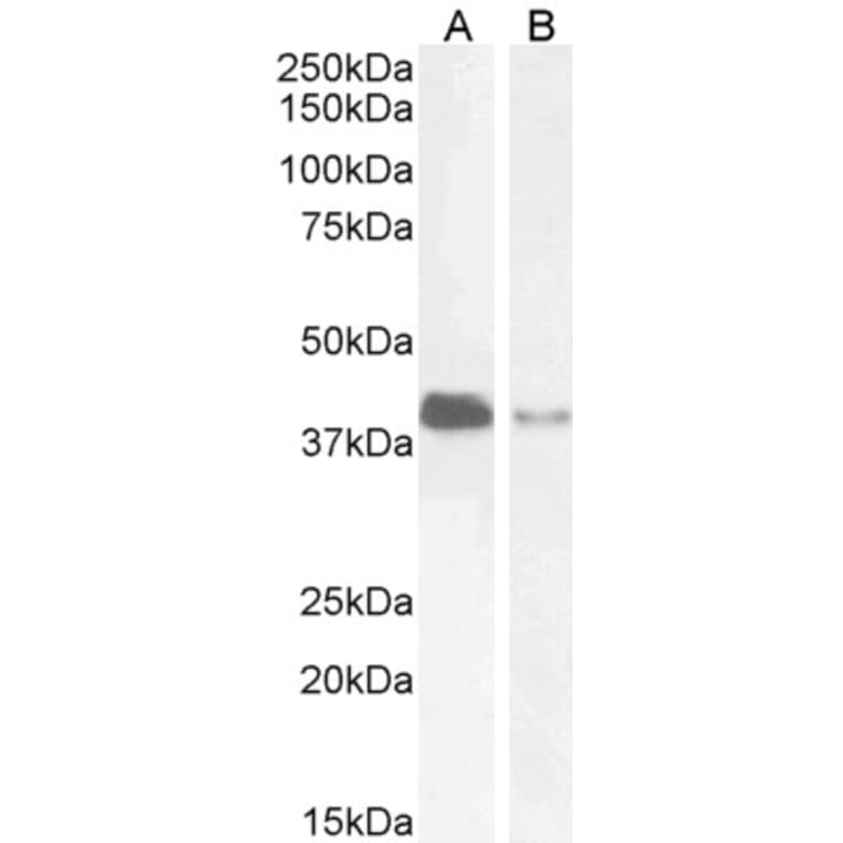 Western Blot - Anti-PAR6 alpha Antibody (A83318) - Antibodies.com