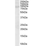 Western Blot - Anti-Asef Antibody (A83320) - Antibodies.com