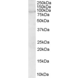 Western Blot - Anti-ARHGEF4 Antibody (A83320) - Antibodies.com