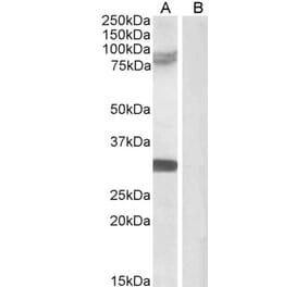 Western Blot - Anti-TRIM2 Antibody (A83321) - Antibodies.com