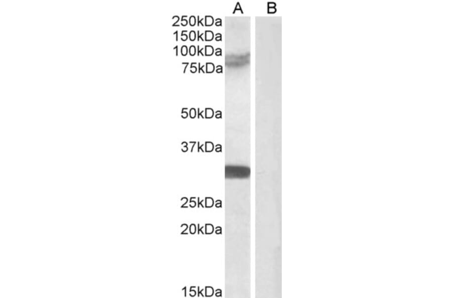 Western Blot - Anti-TRIM2 Antibody (A83321) - Antibodies.com