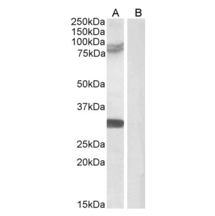 Western Blot - Anti-TRIM2 Antibody (A83321) - Antibodies.com