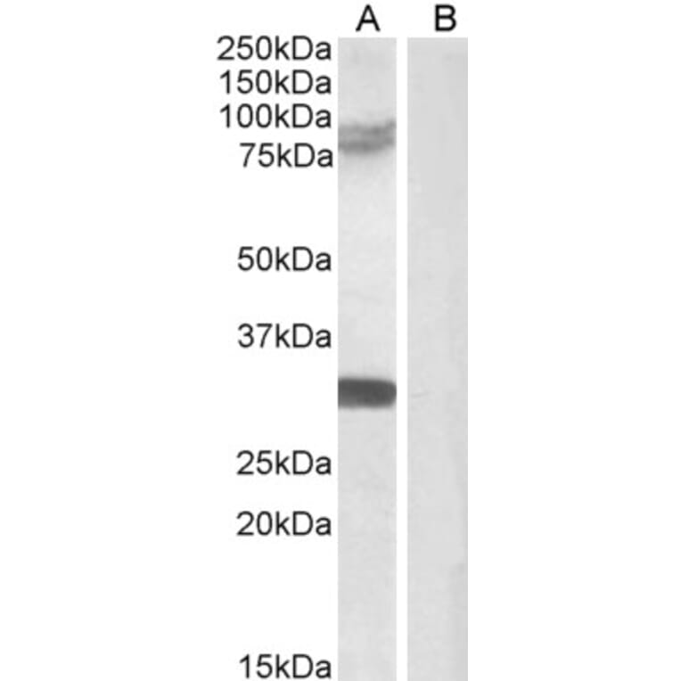 Western Blot - Anti-TRIM2 Antibody (A83321) - Antibodies.com