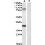 Western Blot - Anti-TRIM2 Antibody (A83321) - Antibodies.com