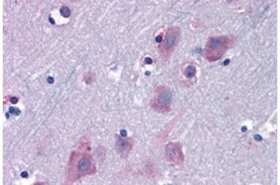 Immunohistochemistry - Anti-TRIM2 Antibody (A83321) - Antibodies.com