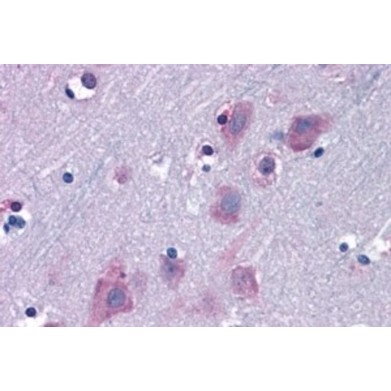 Immunohistochemistry - Anti-TRIM2 Antibody (A83321) - Antibodies.com