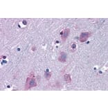 Immunohistochemistry - Anti-TRIM2 Antibody (A83321) - Antibodies.com