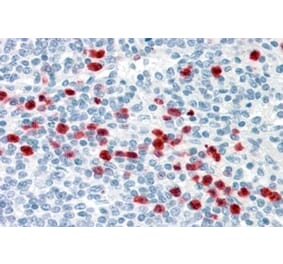 Immunohistochemistry - Anti-GCC185 Antibody (A83322) - Antibodies.com