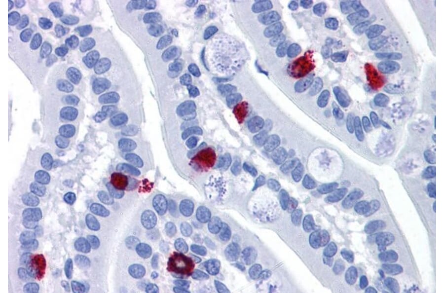 Immunohistochemistry - Anti-GCC185 Antibody (A83322) - Antibodies.com