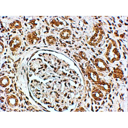 Immunohistochemistry - Anti-VPS41 Antibody (A83323) - Antibodies.com