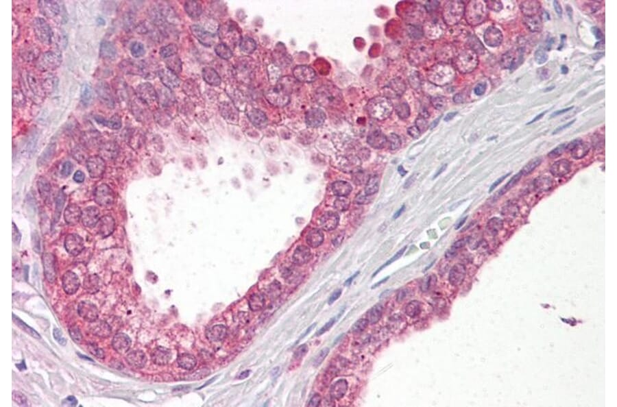Immunohistochemistry - Anti-VPS41 Antibody (A83323) - Antibodies.com