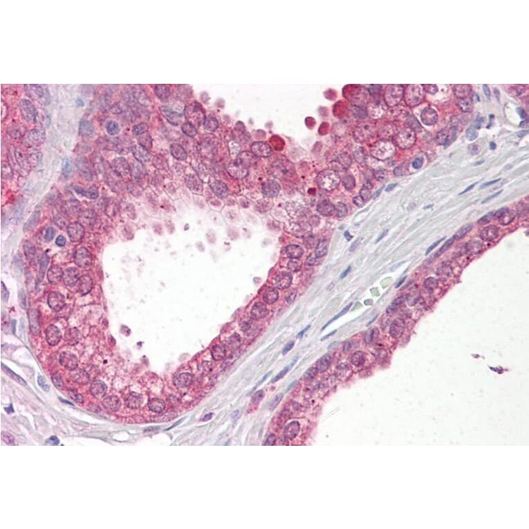 Immunohistochemistry - Anti-VPS41 Antibody (A83323) - Antibodies.com