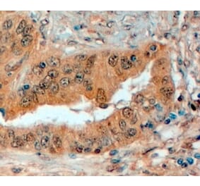 Immunohistochemistry - Anti-Semaphorin 3E Antibody (A83324) - Antibodies.com