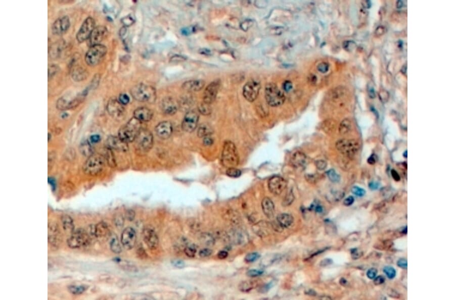 Immunohistochemistry - Anti-Semaphorin 3E Antibody (A83324) - Antibodies.com