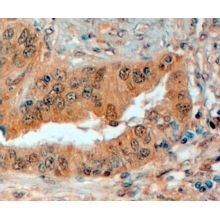 Immunohistochemistry - Anti-Semaphorin 3E Antibody (A83324) - Antibodies.com