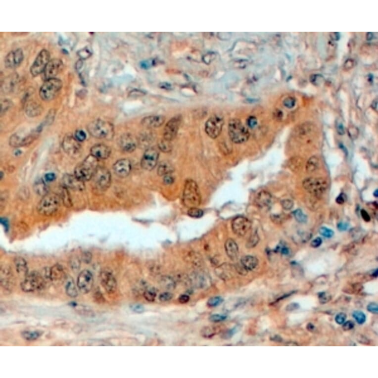 Immunohistochemistry - Anti-Semaphorin 3E Antibody (A83324) - Antibodies.com