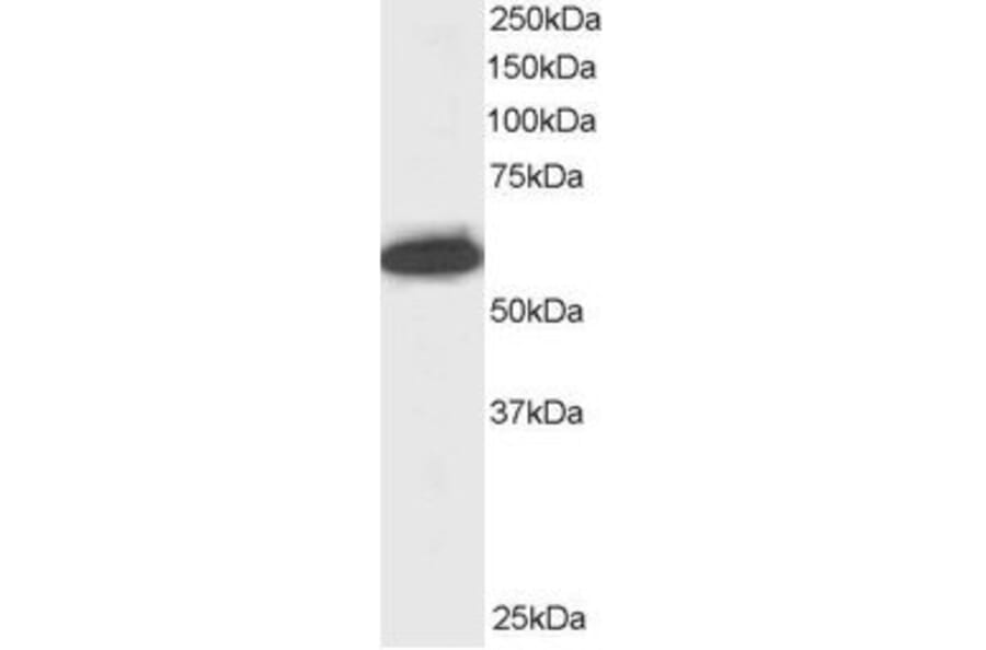 Western Blot - Anti-NUP50 Antibody (A83325) - Antibodies.com