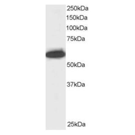 Western Blot - Anti-NUP50 Antibody (A83325) - Antibodies.com