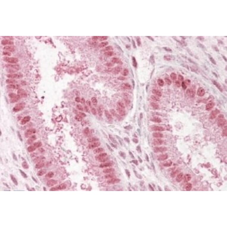 Immunohistochemistry - Anti-NUP50 Antibody (A83325) - Antibodies.com