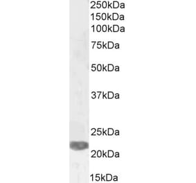 Western Blot - Anti-PRX-1 Antibody (A83327) - Antibodies.com