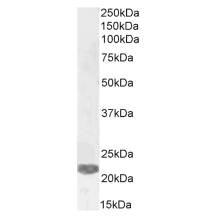 Western Blot - Anti-PRX-1 Antibody (A83327) - Antibodies.com