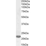 Western Blot - Anti-PRX-1 Antibody (A83327) - Antibodies.com