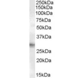 Western Blot - Anti-PRRX1 Antibody (A83327) - Antibodies.com