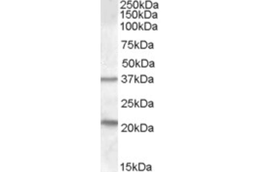 Western Blot - Anti-TUSC3 Antibody (A83328) - Antibodies.com