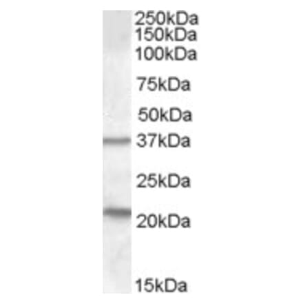 Western Blot - Anti-TUSC3 Antibody (A83328) - Antibodies.com
