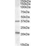 Western Blot - Anti-TUSC3 Antibody (A83328) - Antibodies.com