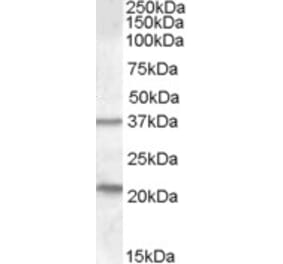 Western Blot - Anti-TUSC3 Antibody (A83328) - Antibodies.com