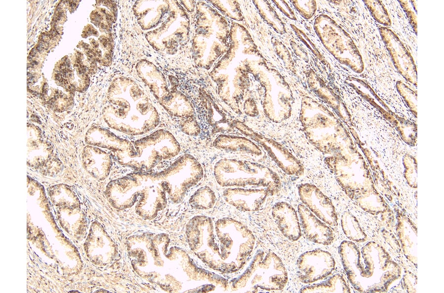 Immunohistochemistry - Anti-TUSC3 Antibody (A83328) - Antibodies.com