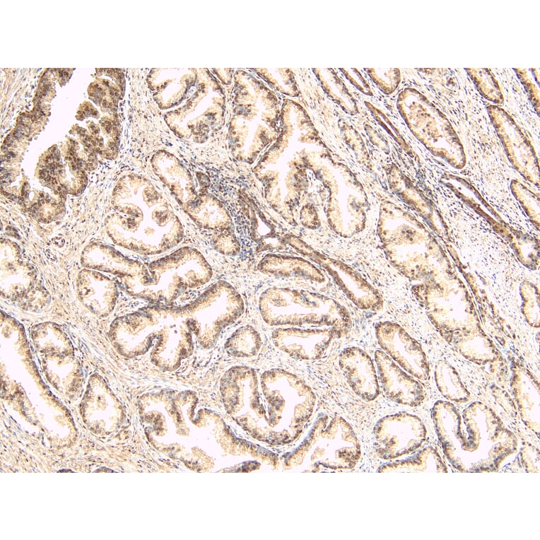 Immunohistochemistry - Anti-TUSC3 Antibody (A83328) - Antibodies.com