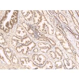 Immunohistochemistry - Anti-TUSC3 Antibody (A83328) - Antibodies.com