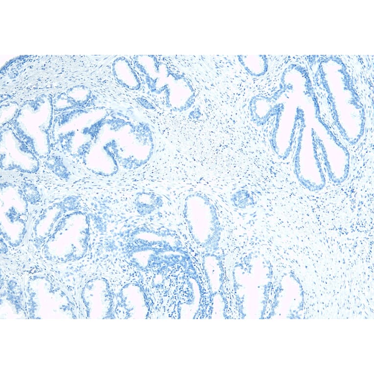 Immunohistochemistry - Anti-TUSC3 Antibody (A83328) - Antibodies.com