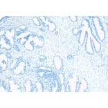 Immunohistochemistry - Anti-TUSC3 Antibody (A83328) - Antibodies.com