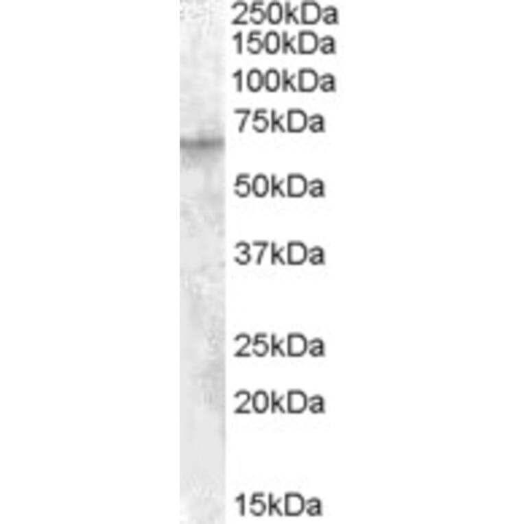 Western Blot - Anti-IGF2BP2/IMP-2 Antibody (A83329) - Antibodies.com