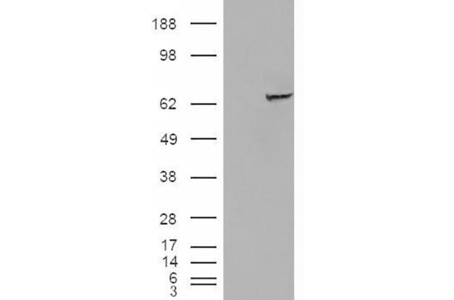 Western Blot - Anti-IGF2BP2/IMP-2 Antibody (A83329) - Antibodies.com