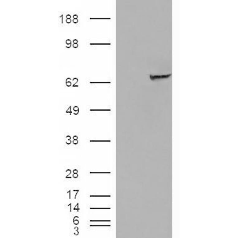 Western Blot - Anti-IGF2BP2/IMP-2 Antibody (A83329) - Antibodies.com
