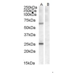 Western Blot - Anti-CERT Antibody (A83332) - Antibodies.com